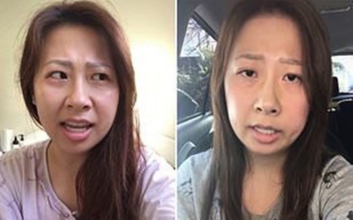 Sau khi cắt Amidan, người phụ nữ Úc nói giọng Ireland trong ngỡ ngàng