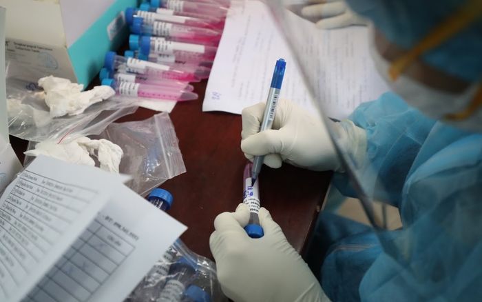 Sáng 21/5: Ghi nhận 24 ca mắc Covid-19 mới đều là F1