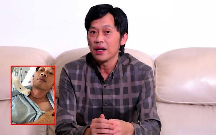 Người thân xác nhận NSƯT Hoài Linh mắc ung thư tuyến giáp, đã phẫu thuật thành công