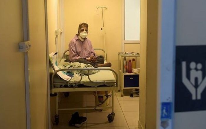 Bệnh nhân khỏi Covid-19 tử vong vì nhiễm nấm đen, vàng, trắng