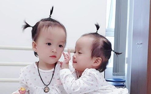 Cặp song sinh dính liền Trúc Nhi - Diệu Nhi tròn 2 tuổi: Đã có thể chạy loanh quanh nhà, nói bi bô líu lo
