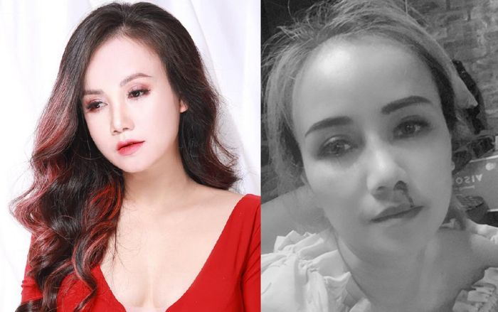 Diễn viên Hoàng Yến bị chồng thứ tư cầm dao đe doạ, đấm chảy máu tại quán ăn