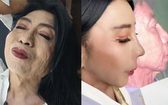 'Hotgirl chuyển giới' Thái Lan đi tân trang làn da nhàu nhĩ, cái kết khiến dân tình muốn 'bật ngửa'