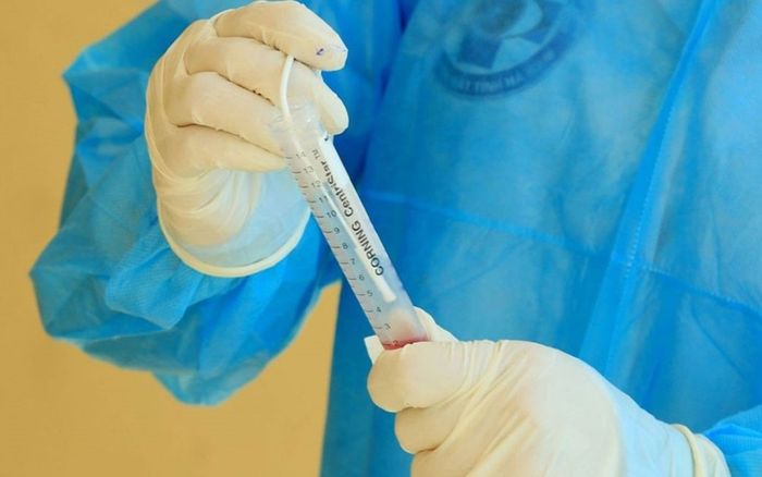 Công nhân không đi xét nghiệm vẫn có giấy âm tính Covid-19, doanh nghiệp liên quan nói gì?