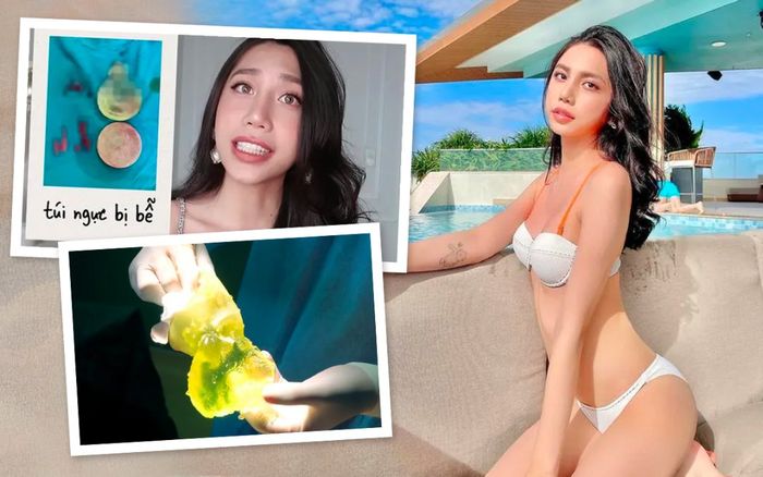 Đi 'độ loa', bạn thân chuyển giới của Lynk Lee tá hoả khi túi ngực cũ đã vỡ tung toé