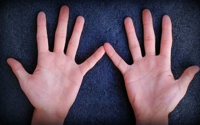 Bàn tay có điểm vàng này đích thị là con cháu Thần Tài: Số 3 cực kỳ hiếm, chỉ 1.5% người trên thế giới có