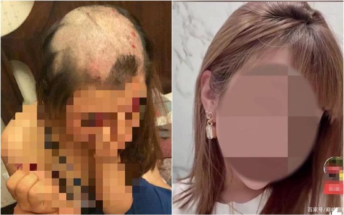 Vợ bị chồng cạo trọc đầu, nguyên nhân khiến dân mạng dậy sóng xót xa