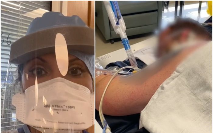 Bác sĩ chia sẻ hình ảnh đau lòng về các bệnh nhân Covid-19 trong phòng điều trị tích cực