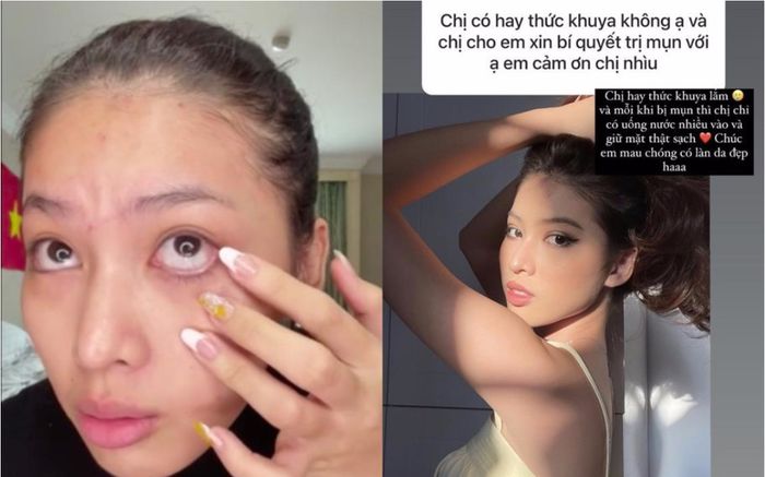 Rũ bỏ son phấn, Á hậu Ngọc Thảo lộ da mặt chi chít mụn, mắt thâm quầng