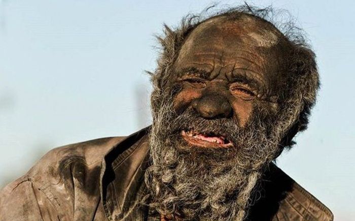 'Người đàn ông bẩn nhất thế giới' không tắm suốt 67 năm qua