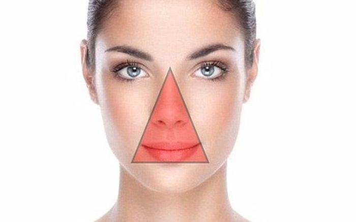 Nặn mụn ở vùng 'tam giác tử thần' nhớ để ý điều này nếu không muốn rước họa vào thân