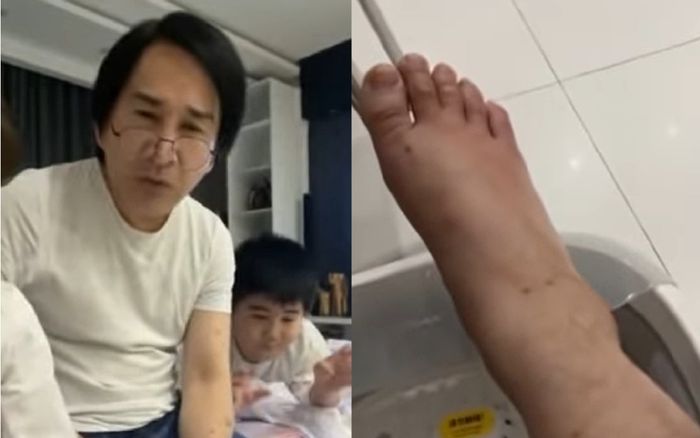 NSƯT Kim Tử Long trở bệnh, 'đau tới mức không đi nổi'