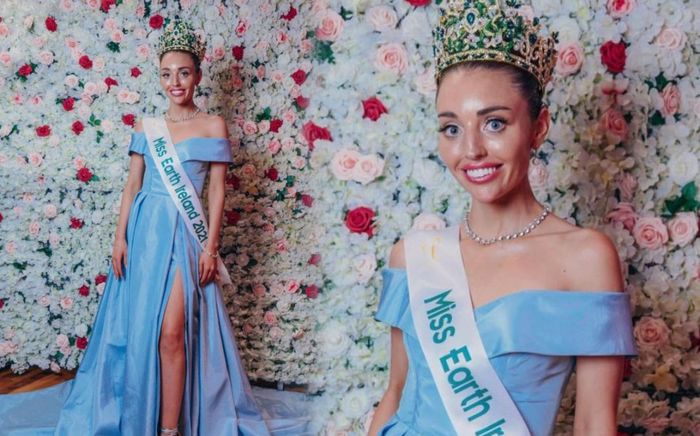 Vừa đăng quang, Tân Miss Earth Ireland 2021 bị chê như phẫu thuật thẩm mỹ bị lỗi