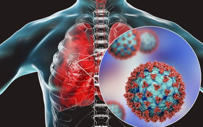 Phát hiện mới về lượng virus SARS-CoV-2 trong phổi gây tử vong ở bệnh nhân Covid-19