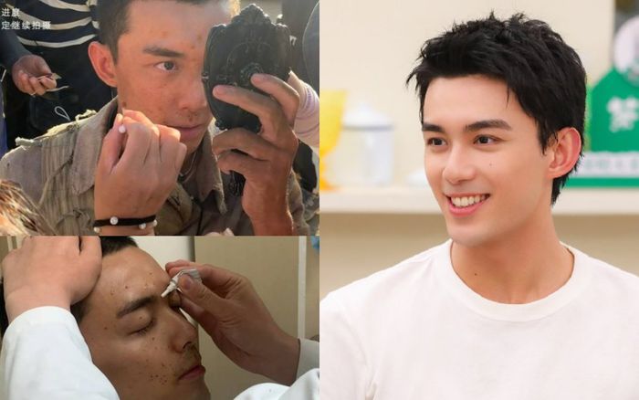 Ngô Lỗi gặp nạn bị thương khắp mặt trên phim trường, hành động sau đó khiến nhiều người nể phục