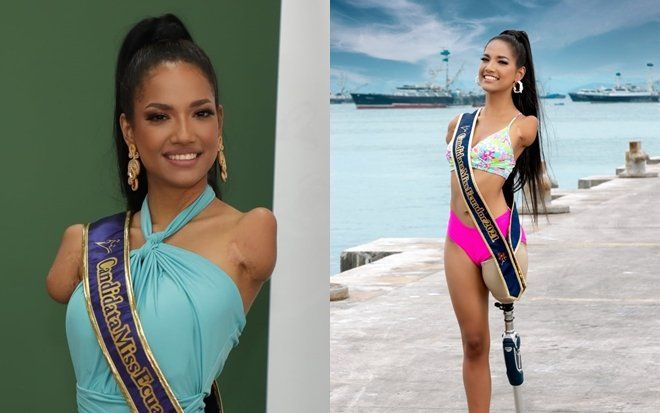 Câu chuyện cảm động về mỹ nữ khuyết tật và hành trình gian nan đến với Miss Universe