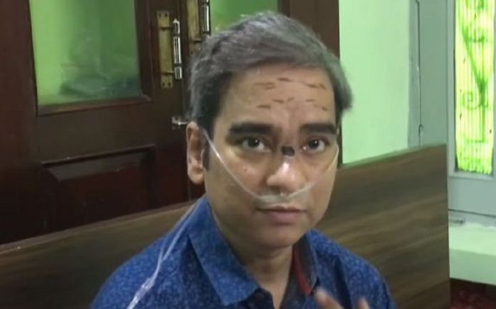 Vật lộn với Covid-19 suốt 130 ngày, người đàn ông trở về từ cõi chết với khuôn mặt chằng chịt vết sẹo