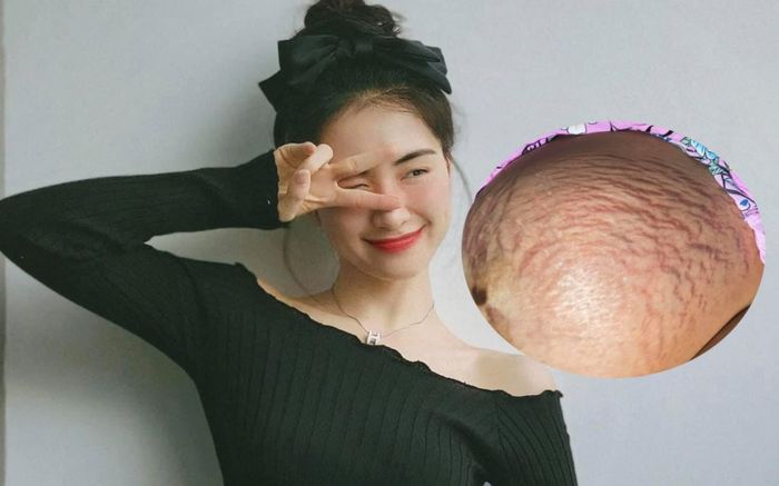 Hòa Minzy lần đầu chia sẻ hình ảnh rạn da khi mang thai, netizen xúc động: 'Thương lắm những người mẹ'