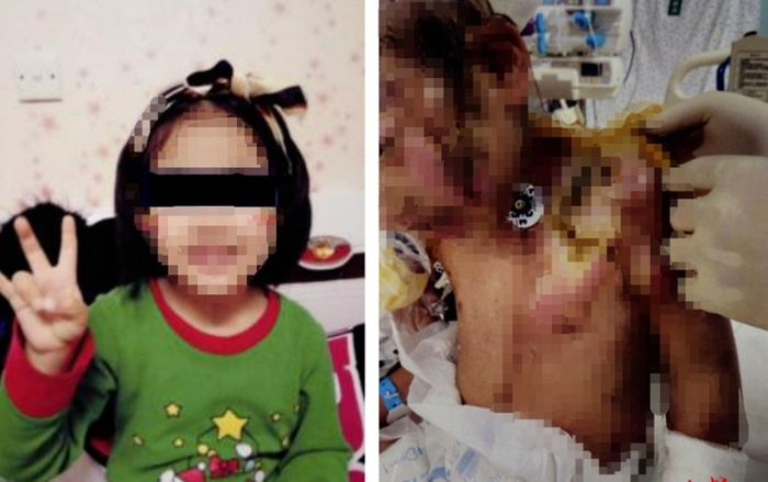 Mẹ ruột và nhân tình tra tấn con gái dã man như thời trung cổ, bản án cuối làm thổi bùng nỗi tức giận