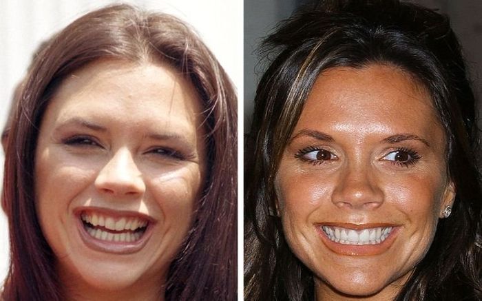 Khuyết điểm nhỏ trên mặt mà khiến các chị đẹp Hollywood điêu đứng nhan sắc