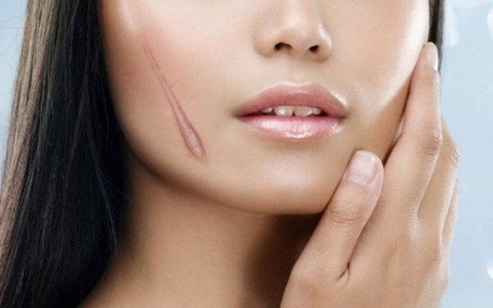 Ai có sẹo ở 5 vị trí này, tiền tài hao tổn, sự nghiệp bết bát, anh em bất hòa