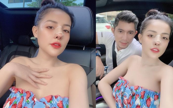 Ngân 98 công khai ảnh sửa mũi, sẵn tiện 'vỗ mặt' anti-fan vì liên tục móc mỉa chuyện 'đập đi xây lại'