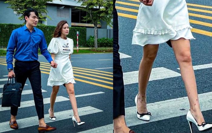 Midu khiến dân tình hốt hoảng với đôi chân đầy vết sẹo, trông rất mất thẩm mỹ