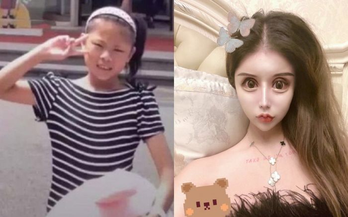 Rich kid Thượng Hải chi 13 tỷ phẫu thuật thẩm mỹ 60 lần, kết quả nhận về như mặt rắn