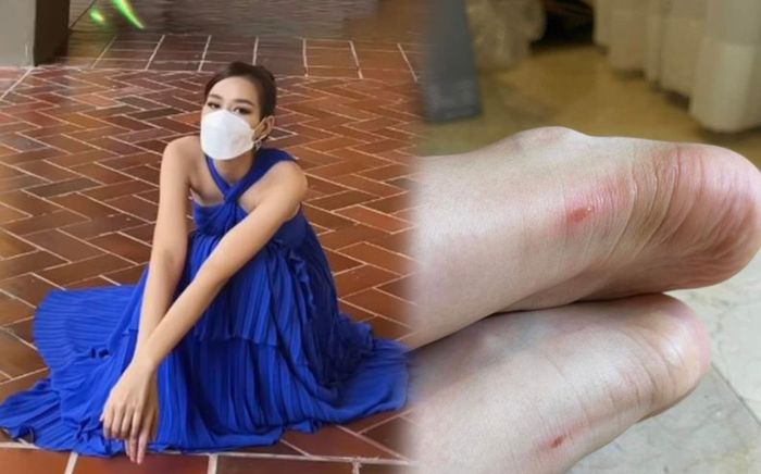 Gặp sự cố với giày cao gót khi đi thi quốc tế, Đỗ Thị Hà phải mang dép lê, Khánh Vân ngón chân phỏng rộp