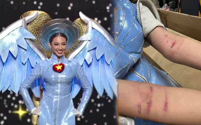 Thùy Tiên bầm cả hai tay, chia sẻ cảm xúc sau khi gặp sự cố trong phần thi trang phục dân tộc