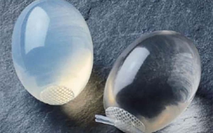 Tinh hoàn bị teo bé như hạt lạc, nam bệnh nhân tha thiết muốn cấy tinh hoàn giả để tự tin với người yêu