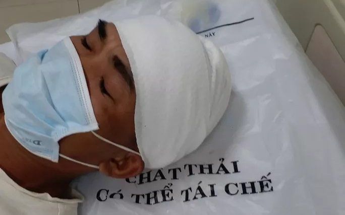 Điều tra vụ 2 người dân vô cớ bị nhóm người dùng mã tấu hành hung phải nhập viện