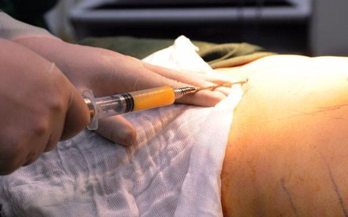 Lại thêm một cô gái tử vong sau khi làm đẹp tại cơ sở thẩm mỹ