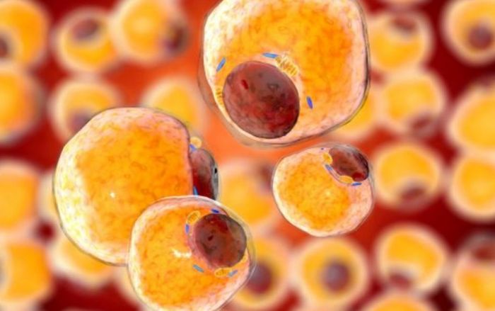 SARS-CoV-2 có thể ẩn trong các tế bào mỡ, khiến người béo phì dễ mắc Covid-19 nặng