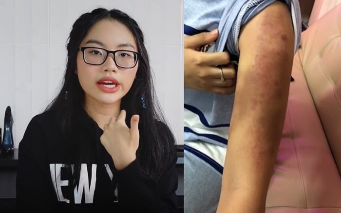 Phương Mỹ Chi gây sốc khi hành hạ bản thân đến mức xước cuống họng, rối loạn kinh nguyệt chỉ vì bị chê