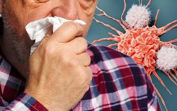 5 đặc điểm của cơn ho cảnh báo ung thư, không phải Covid-19