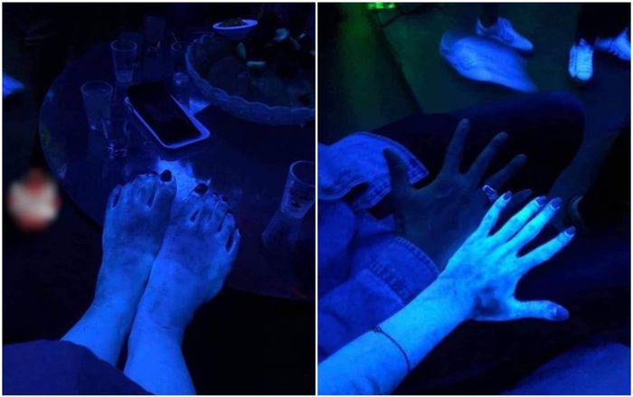 Đi pub cùng với hội bạn, tay chân cô gái bỗng phát sáng như zoombie, biết lý do ai nấy cũng sợ hãi
