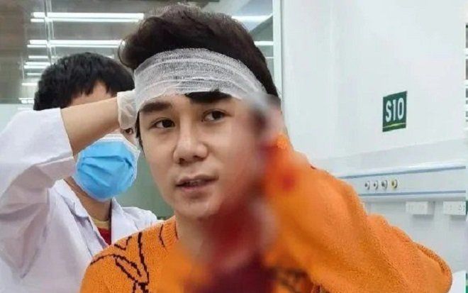 Nam diễn viên 'Thương ngày nắng về' bị chém gây thương tích vì mâu thuẫn khi trên đường về nhà