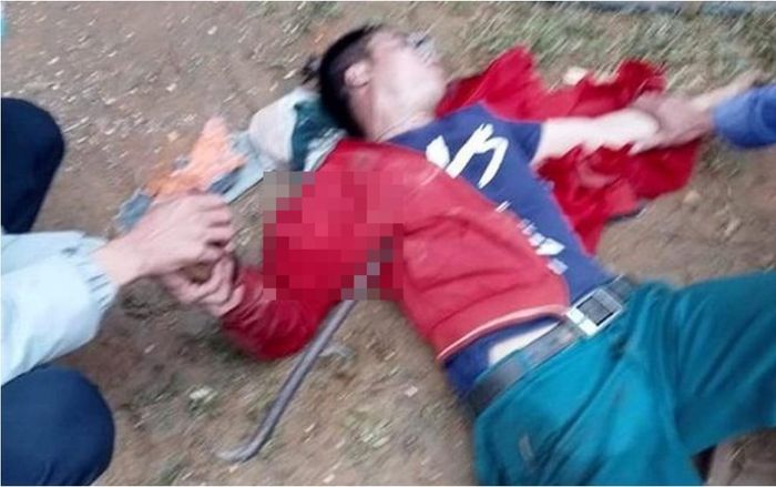 Người đàn ông bị xà beng đâm xuyên ngực khi rơi từ mái nhà xuống
