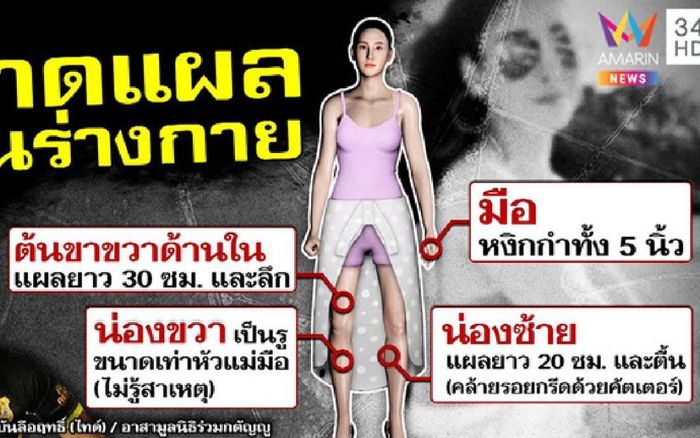 Công bố toàn bộ vết thương trên người diễn viên Chiếc Lá Cuốn Bay, hé lộ một người có khả năng bị khởi tố