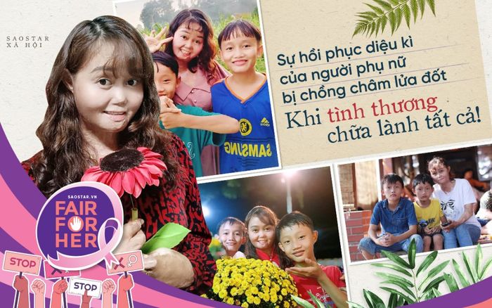 Sự hồi phục diệu kì của người phụ nữ bị chồng châm lửa đốt: Khi tình thương chữa lành tất cả!
