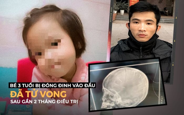 Bé 3 tuổi bị đóng đinh vào đầu đã tử vong sau gần 2 tháng điều trị