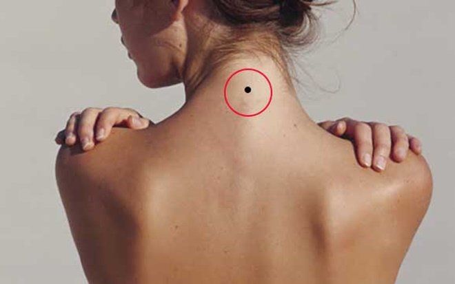 5 nốt ruồi mang quý nhân tới, ai sở hữu đều may mắn hơn người