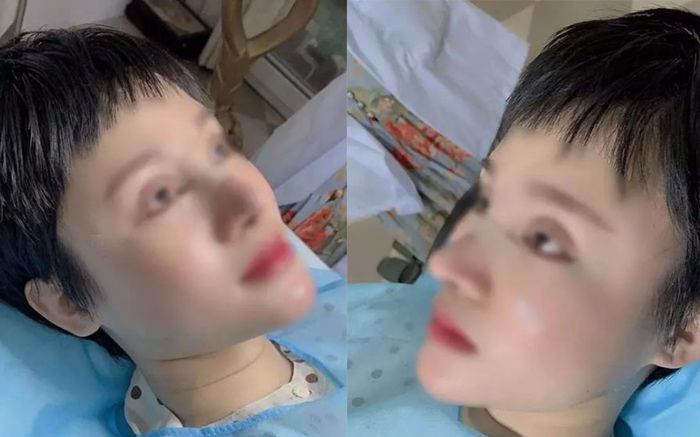 Sốt xình xịch với hình ảnh cô gái quyết tâm phẫu thuật giống Hiền Hồ để có chiếc G63
