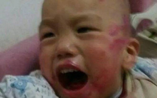 Đi chợ về thấy trên người con bê bết 'máu', bà mẹ 'hú hồn' khi phát hiện ra nguyên nhân sự việc