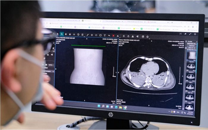 Tin sáng 30-3: Đến nay Hà Nội gần 1,5 triệu ca COVID-19, cứ 5 người có 1 người nhiễm