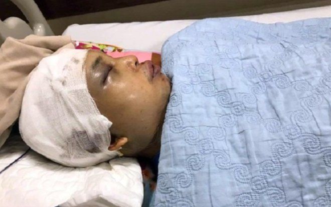 Tạm bắt giữ hai đối tượng đánh vỡ hộp sọ Phó Chủ tịch xã ở Hải Dương