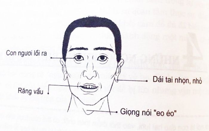 4 nét tướng đàn ông lắm điều nhiều chuyện, dễ gây thị phi khiến ai cũng không ưa