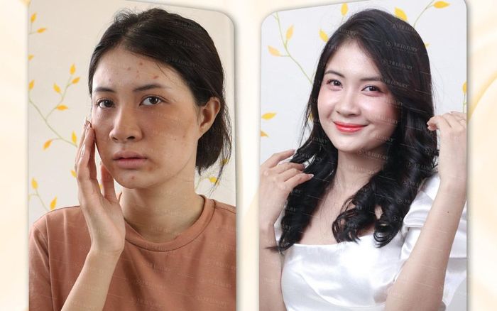 Có nên làm đẹp tại YB Spa không?