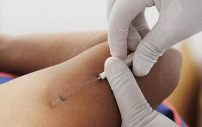 Đi cấy que nhưng vẫn mang thai, nhiều phụ nữ 'ngã ngửa' trước sự thật về nam bác sĩ